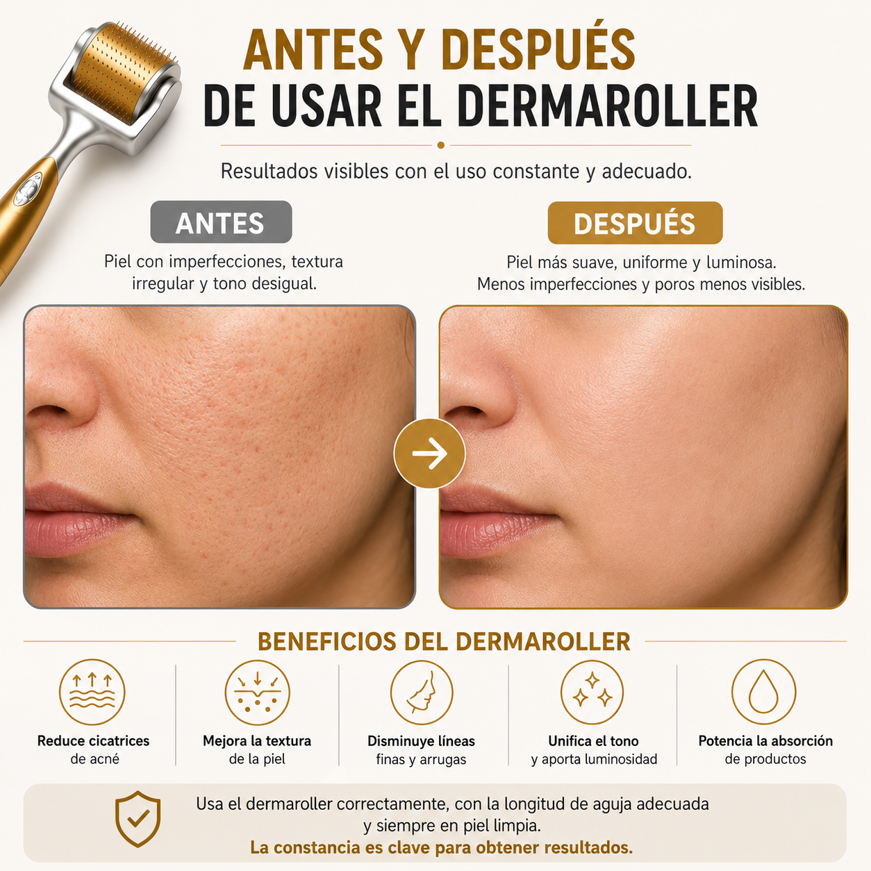 Dermaroller
